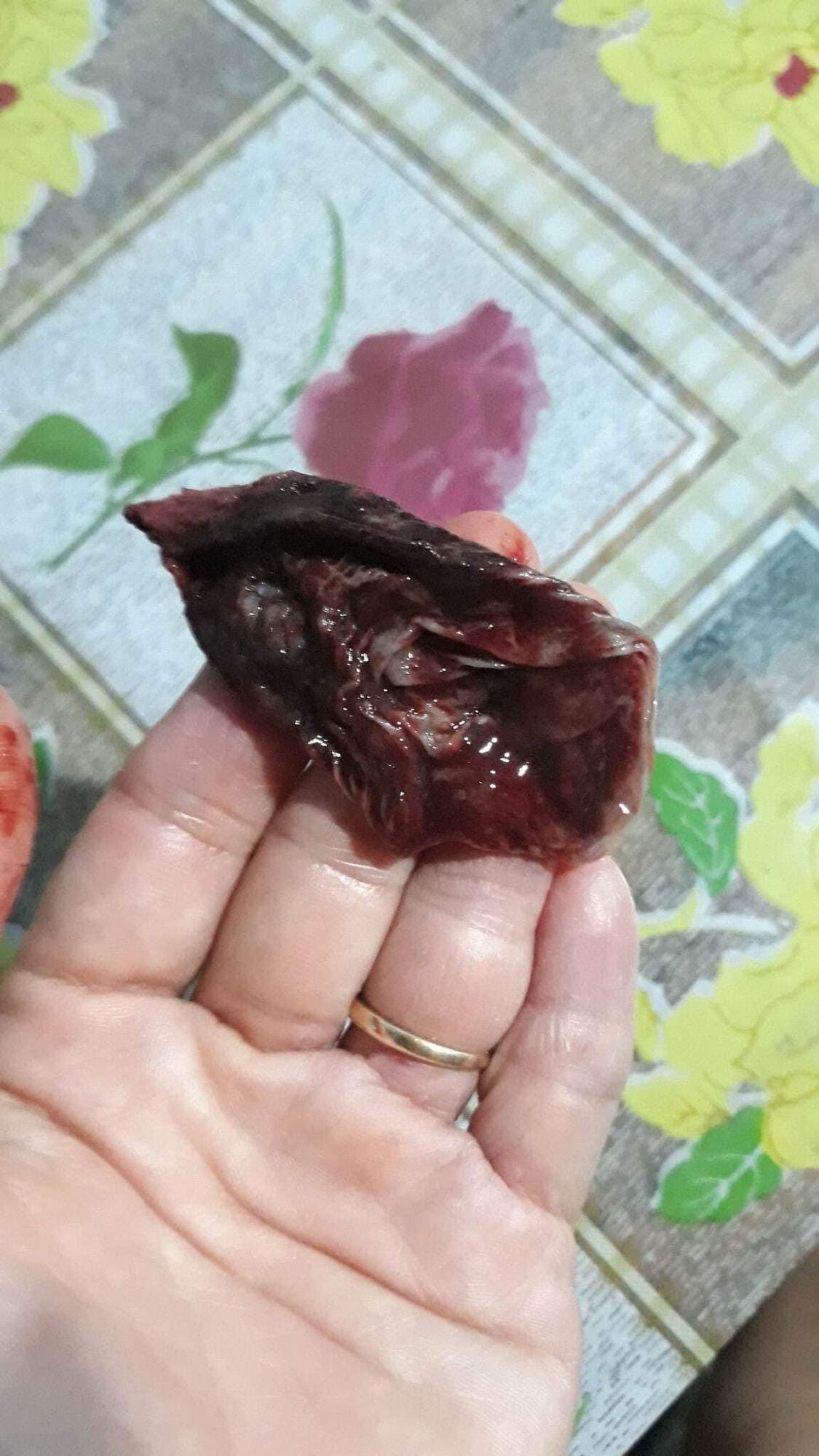 Viên Đ.ặt T.iêu V.iêm Pk ( tách lẻ 5 viên dùng thử)