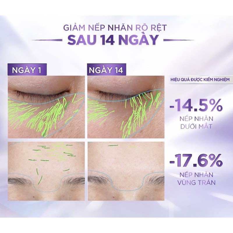 Serum siêu cấp ẩm sáng da L'Oreal Paris Hyaluronic Acid 1.5% 30ml