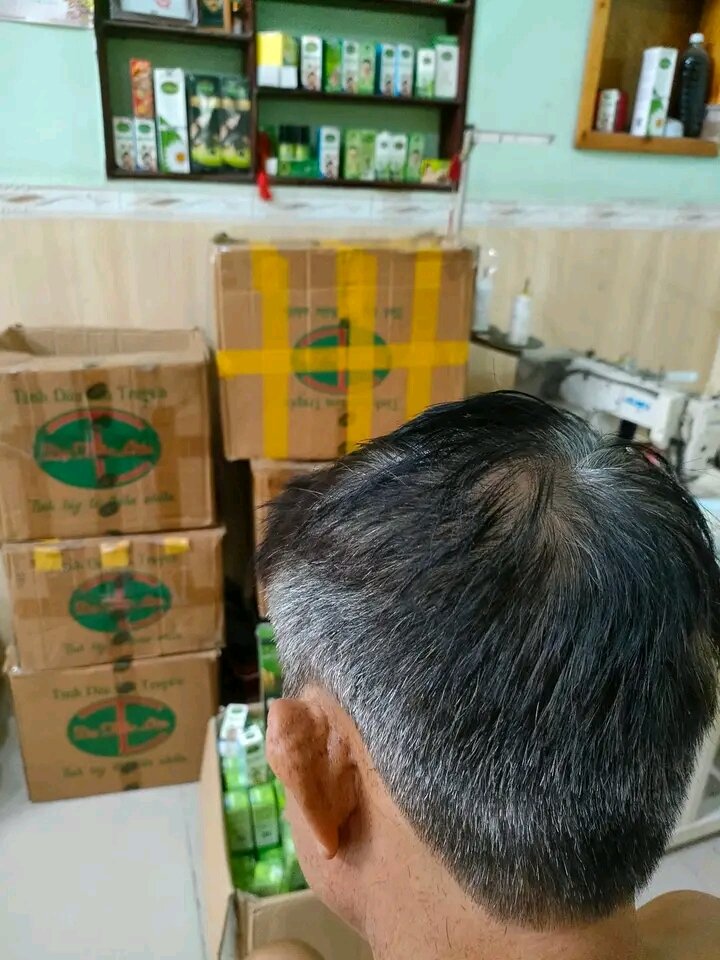 DẦU GỘI PHỦ BẠC DẠ THẢO LIÊN Bán sỉ. 