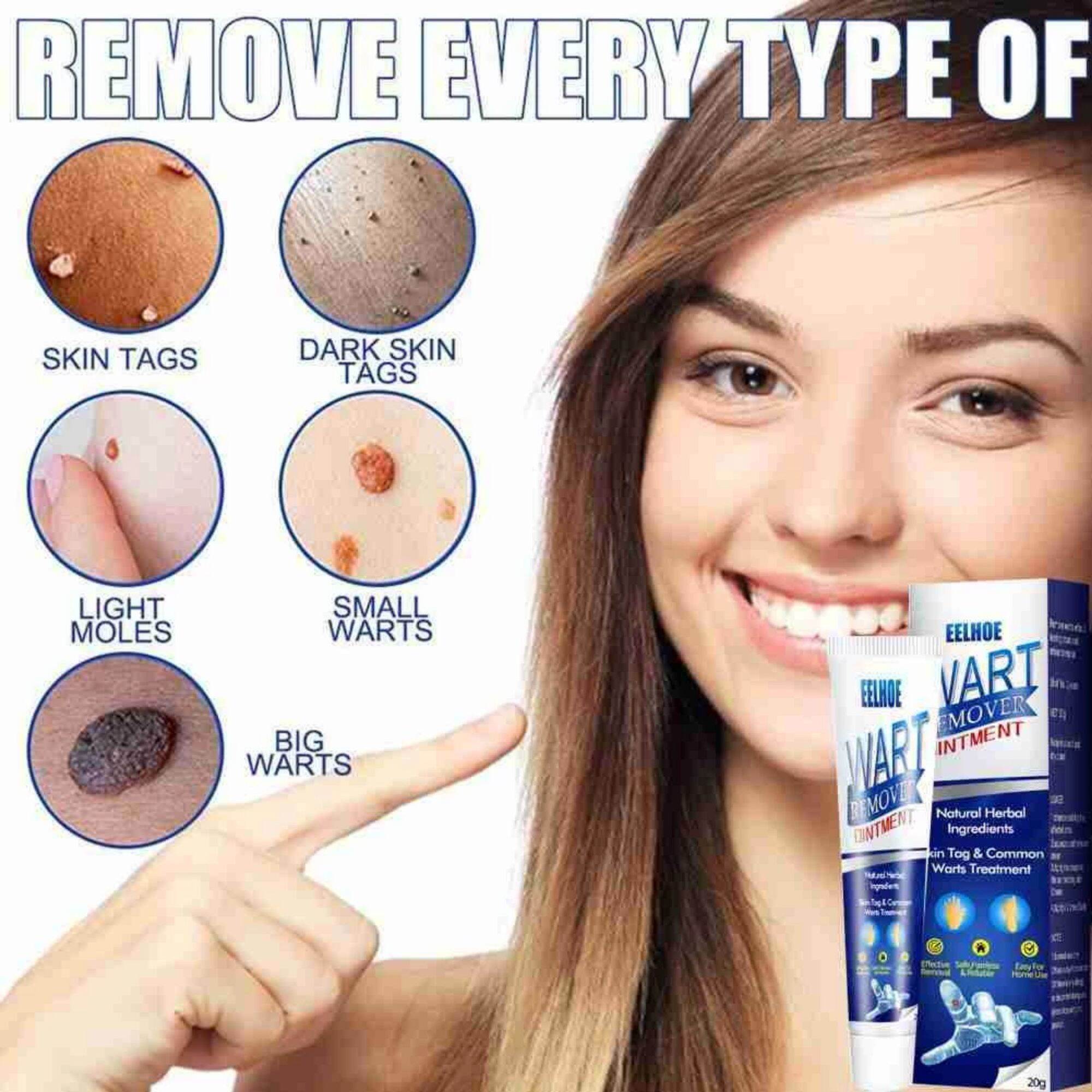 Kem tẩy mụn cóc mụn thịt wart ointment remover dưỡng da kháng khuẩn tinh chất thảo dược thiên nhiên.