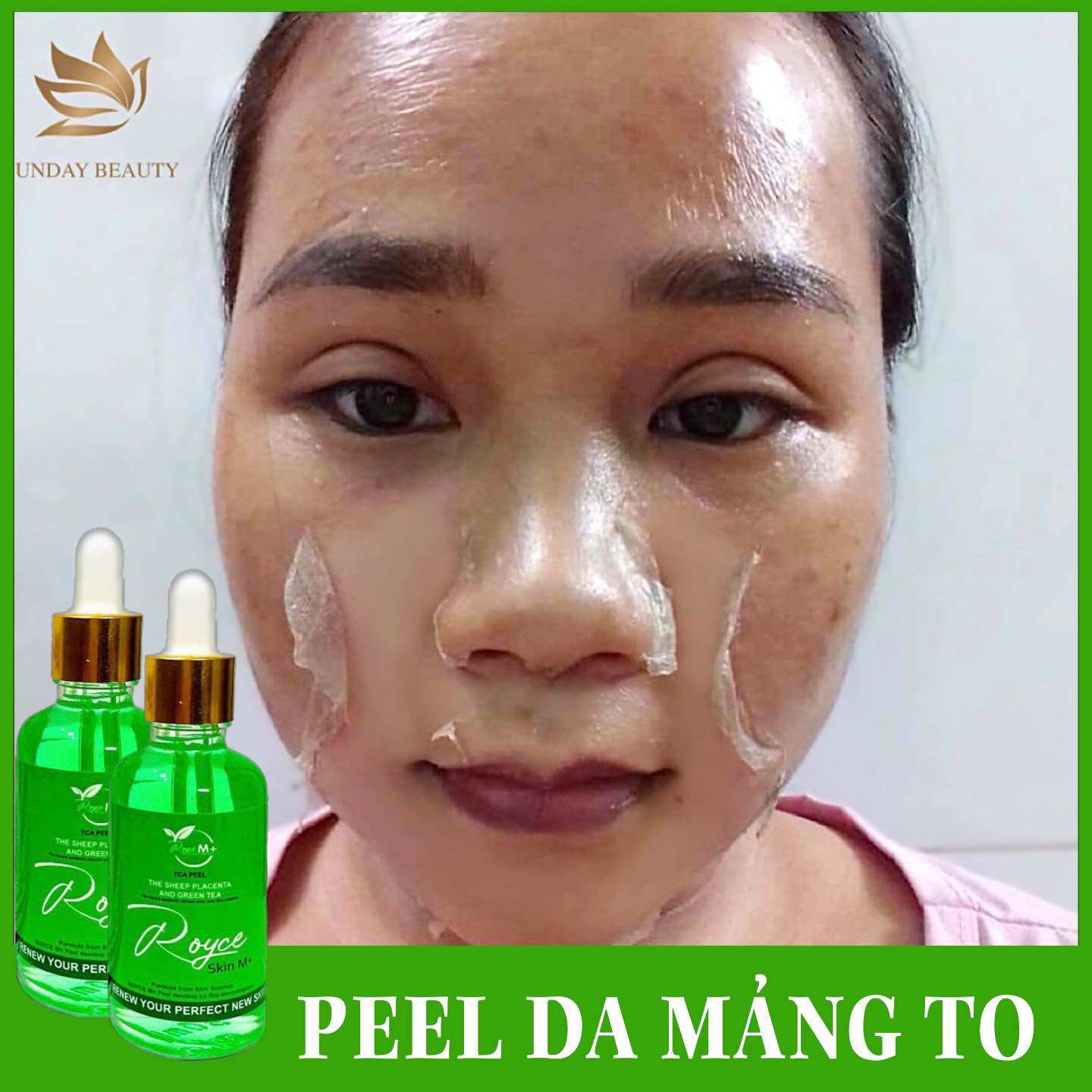 Peel da bong mảng to royce skin m+ peel da - peel da - peel da