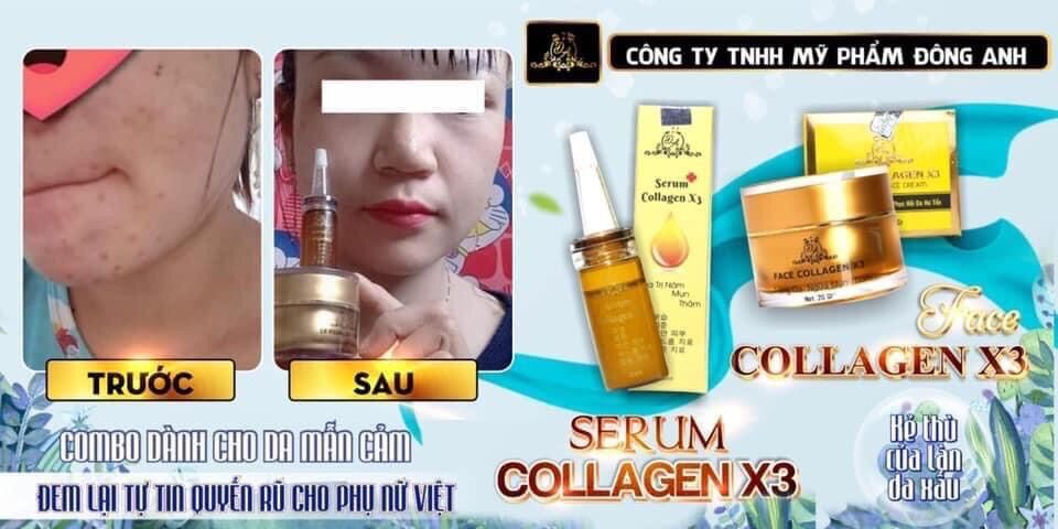 Kem face colagen x3