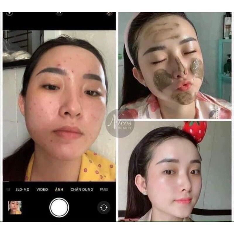 [Chính Hãng] Sữa Rửa Mặt Đông Y Nicos Chính Hãng