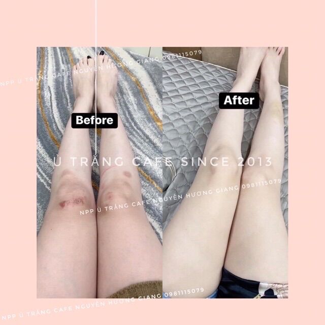 Ủ TRẮNG CAFE ( MUA 1 tặng 1 Bột trà xanh )