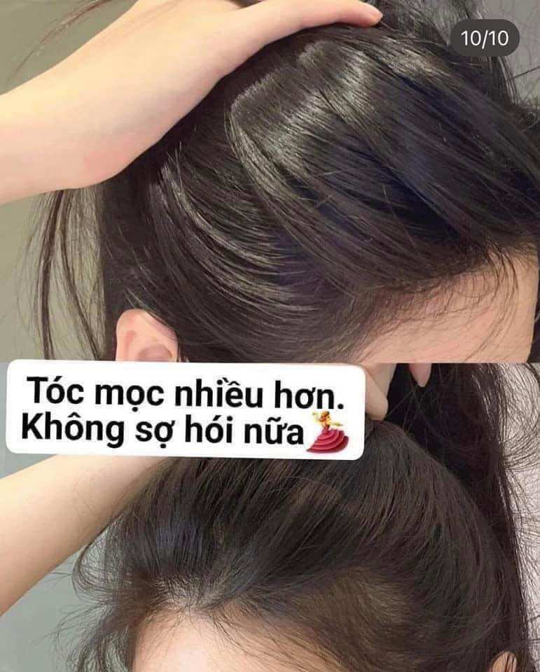 Chai dầu gội gừng boots thái lan