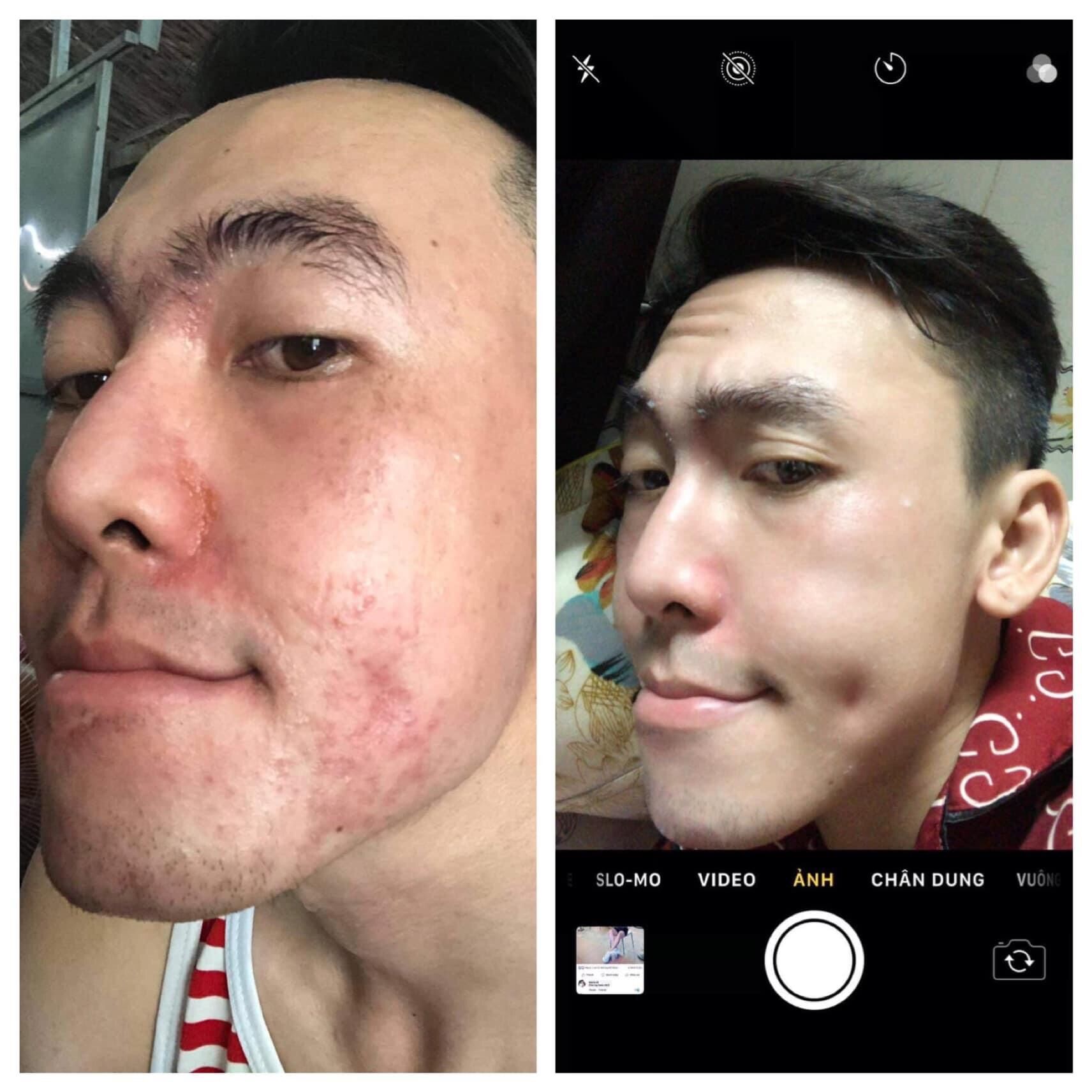 [MPVC + quà]🌸 TINH CHẤT HỒNG SÂM MCSKIN TÁI TẠO DA🌸