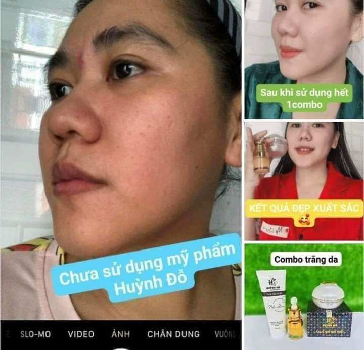 [TẶNG KÈM SERUM VÀNG 24K+ MẶT NẠ] Kem face vip 7 in 1 Huỳnh Đỗ