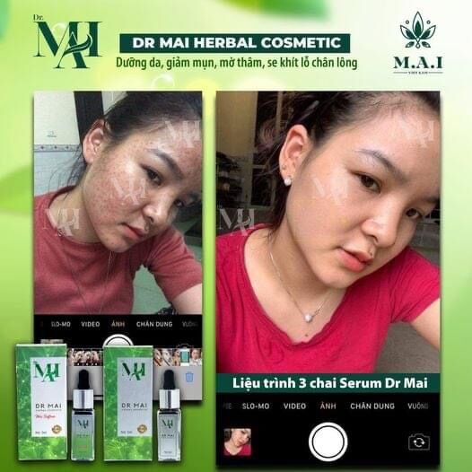 [HCM]DR MAI MIX SAFFON