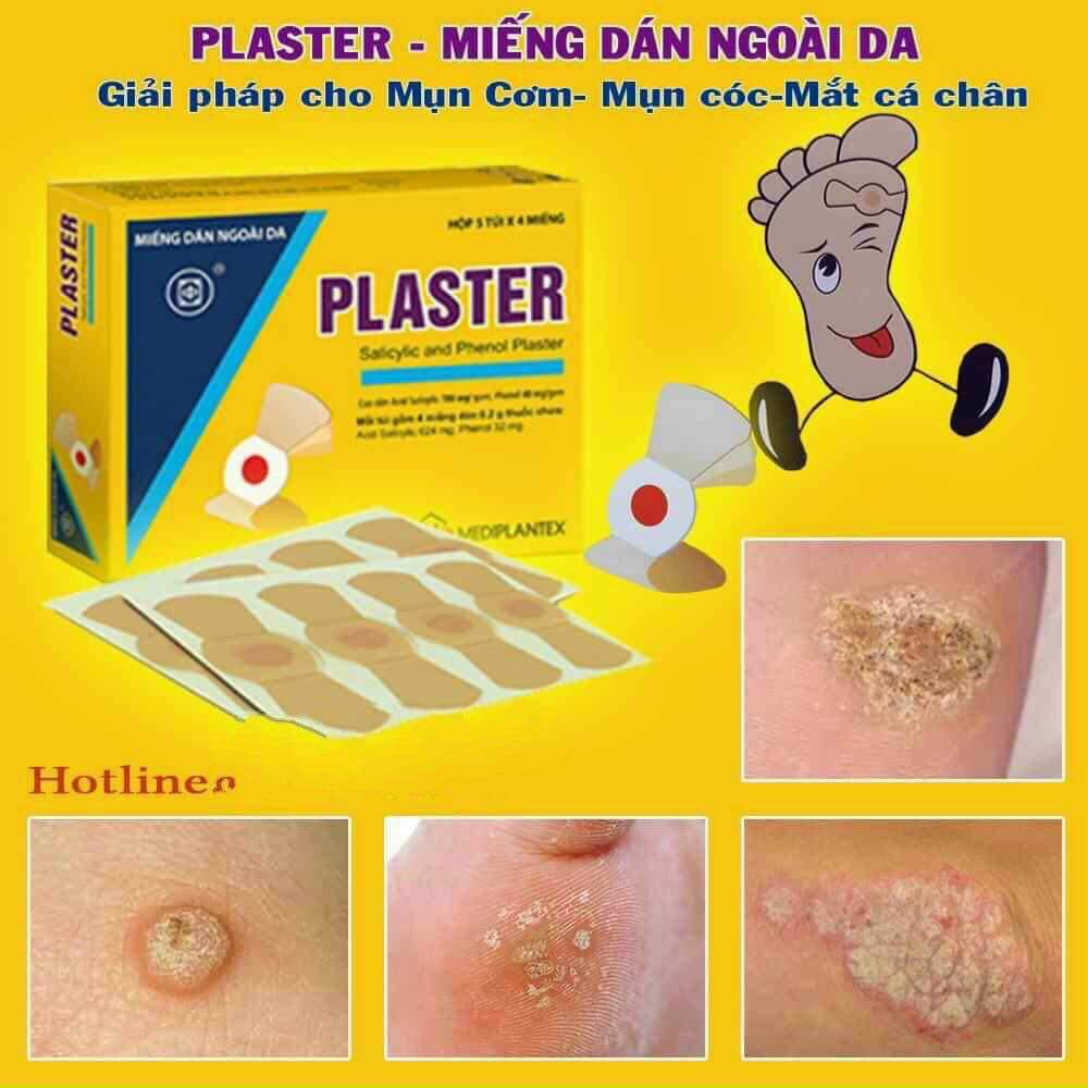 Miếng dán Plaster mụn cơm mụn cóc Plaster Minh an