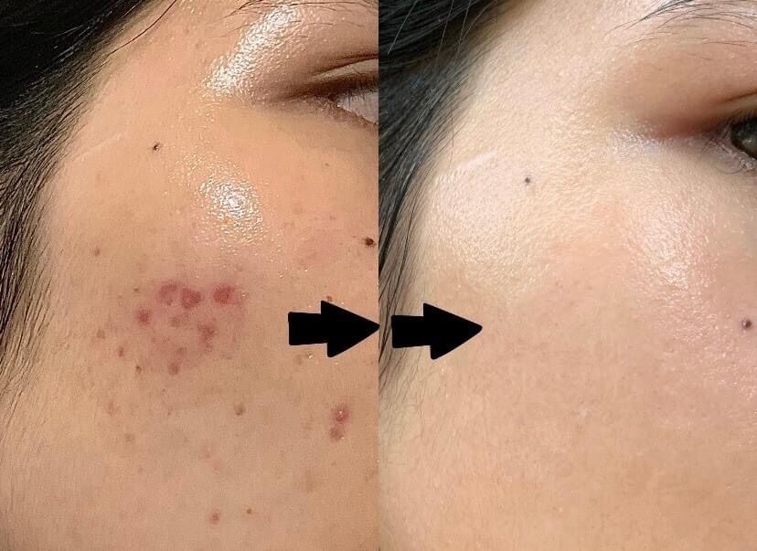 Serum Balance Vitamin C 12% 30ml sáng da, mờ thâm