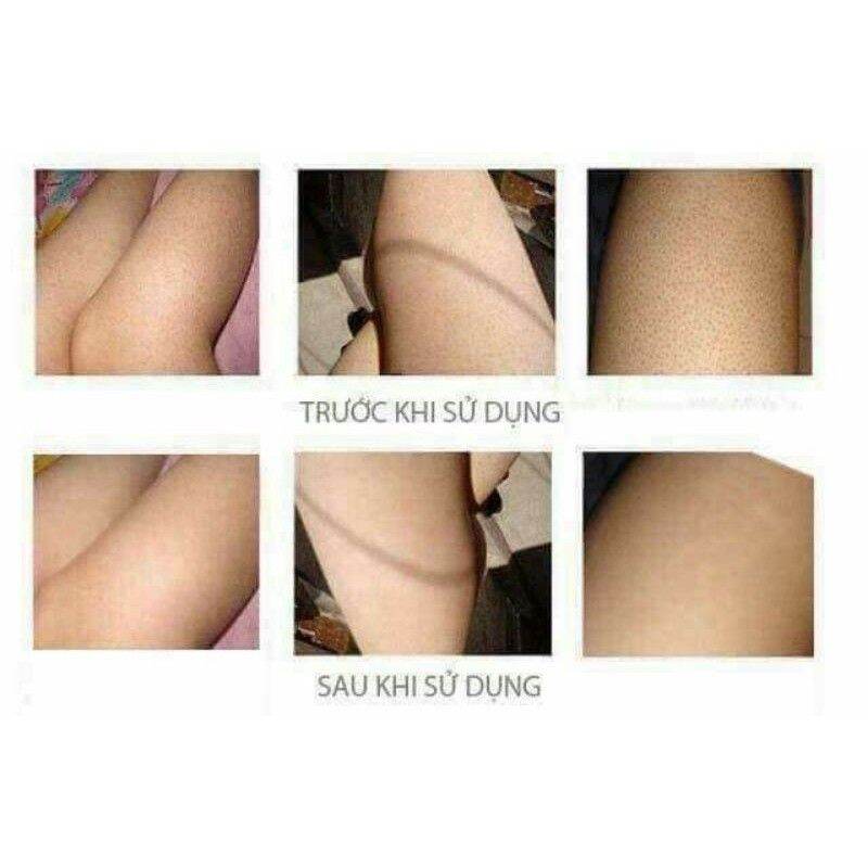 xịt tất che khuyết điểm