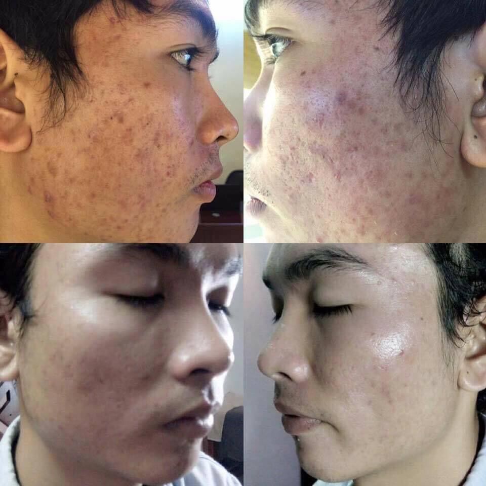 Tái Tạo Da MT (50ml).