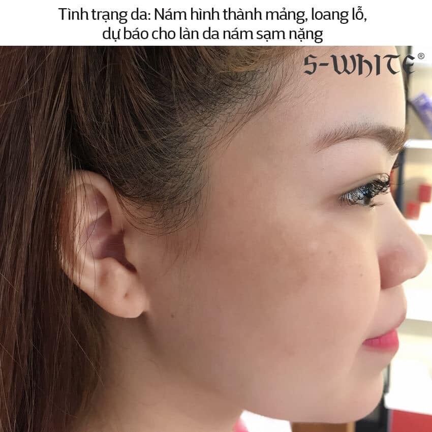 [HCM]Kem nám Swhite ban đêm date mới
