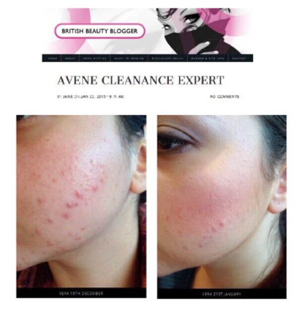 Kem giảm mụn Avene TriAcneal Expert 30ml