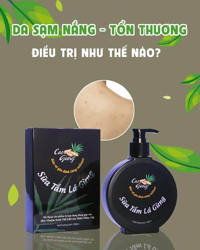 [HCM]sữa tắm lá gừng 300 ml