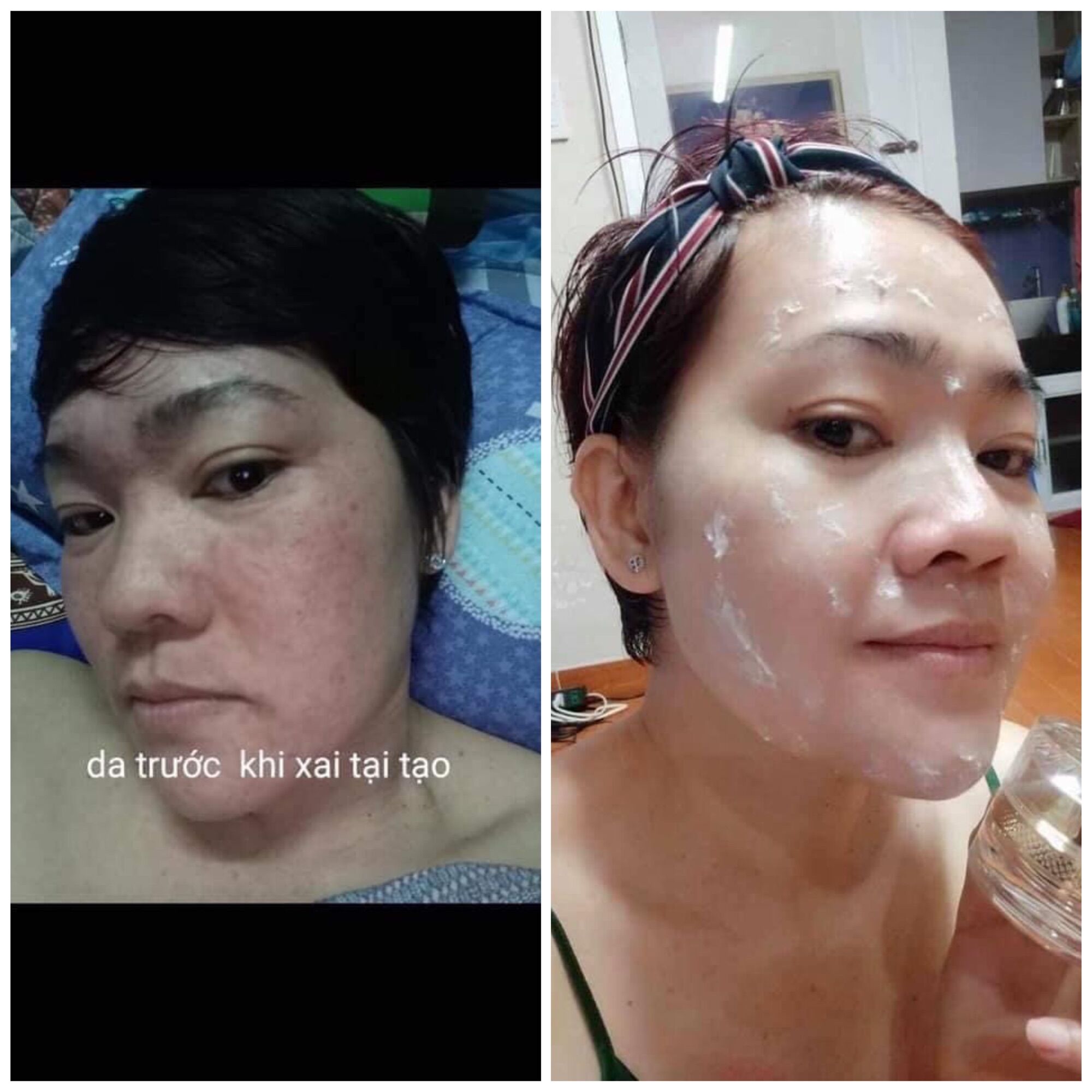 [HCM]Kem tái tạo da Chamomileskill - hàng chính hãng