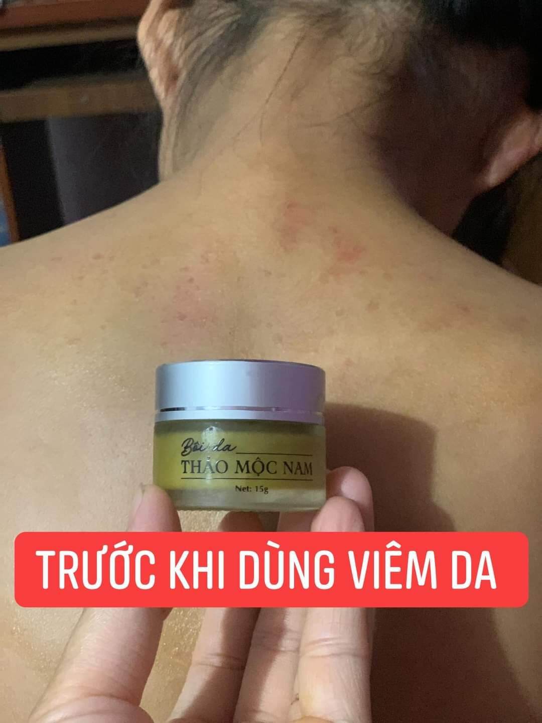 Kem bôi da Thảo Mộc Nam - Mẫu mới 15gr
