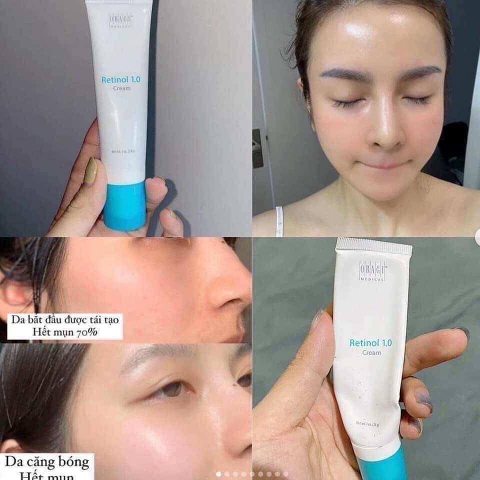 KEM RETINOL OBAGI 1%