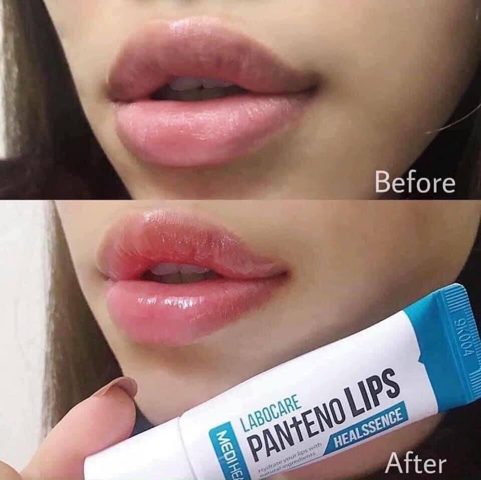 Son dưỡng  thâm môi Labocare Panteno Lips