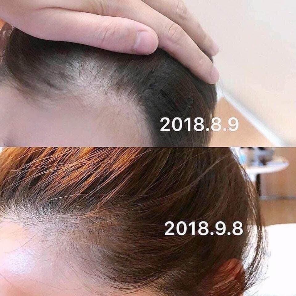 TINH CHẤT MỌC TÓC SATO NHẬT BẢN