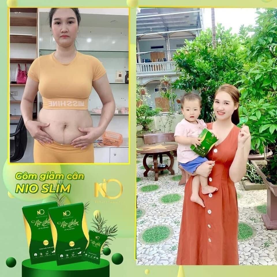 Kẹo Gôm Nio Slim ( Sỉ liệu trình 2 hộp) tặng detoc giảm mỡ bụng