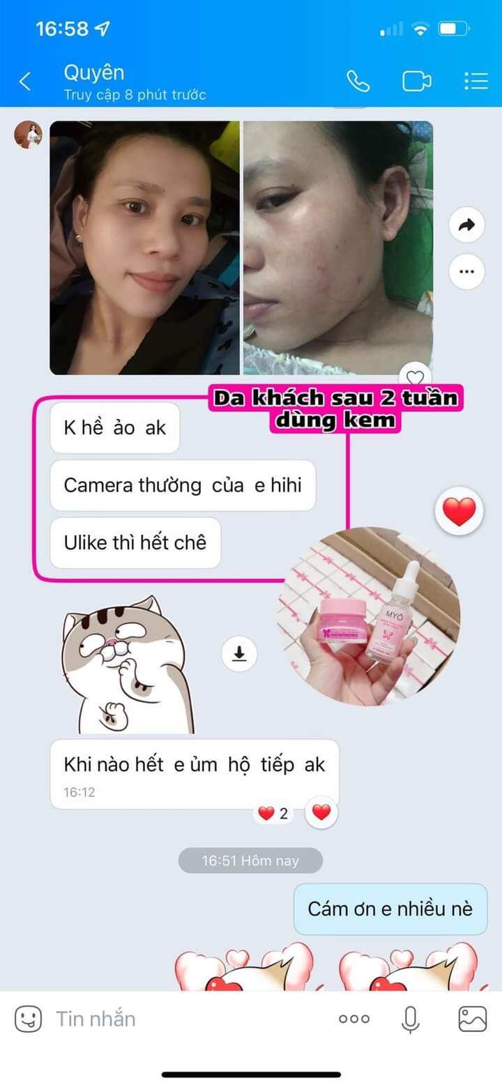 combo kem face + serum MYO 2 Tầng