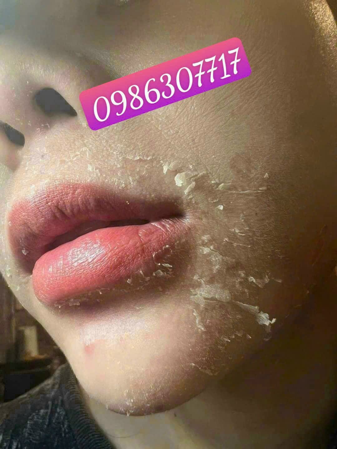 kem tái tạo MH 200k
