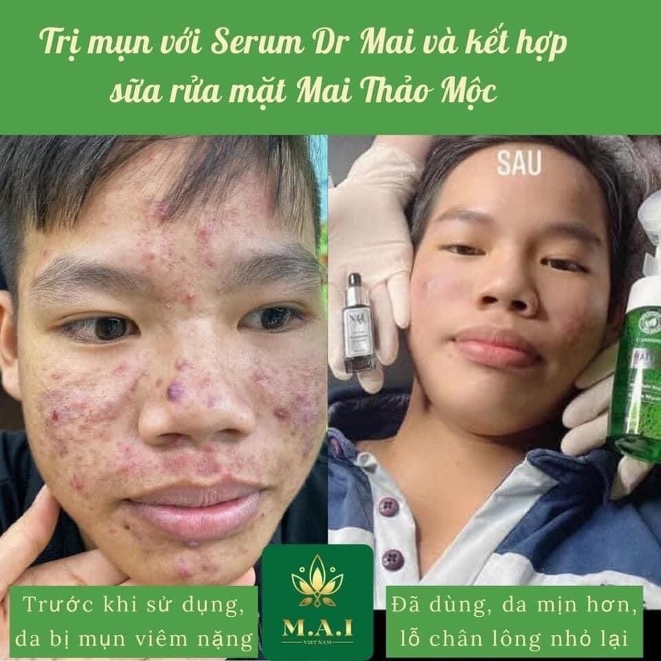 [HCM]DR MAI MIX SAFFON