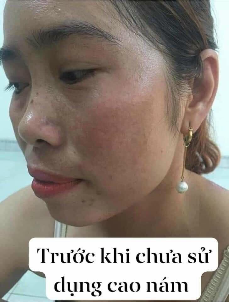Cao Nám Hoàng Cung Magic skin (hộp 13g)