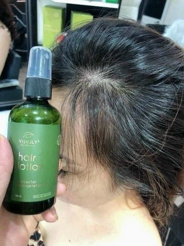 xịt bưởi mọc tóc vijully chính hãngl