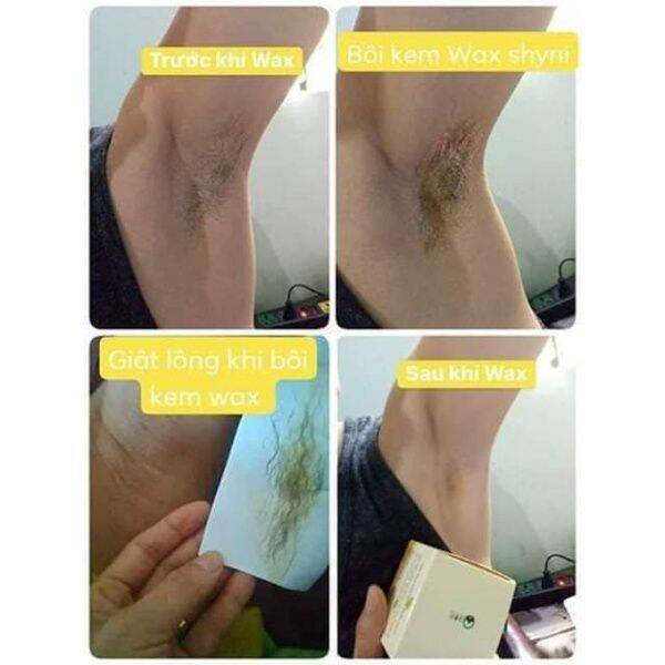 [HCM]Combo triệt lông vĩnh viễn Wax Shiny và Mỡ Trăn