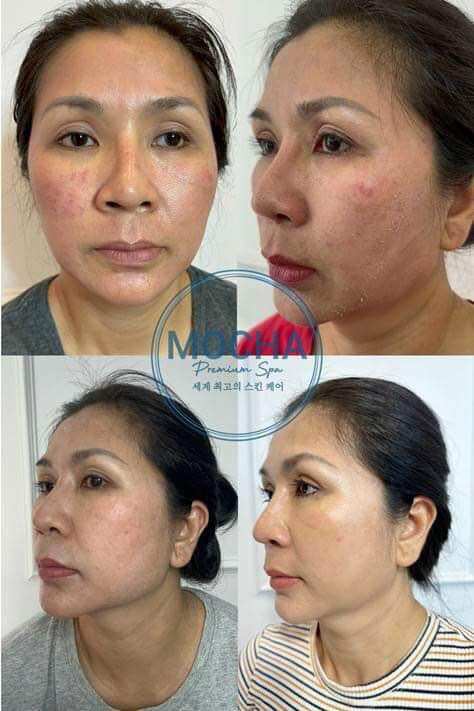 Peel da Mocha Retinol