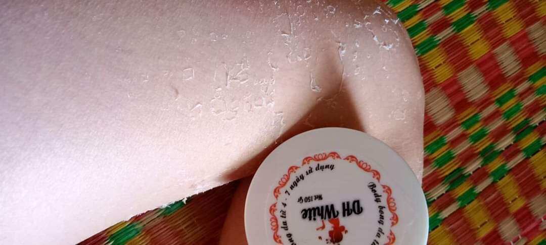 Kem Bong Da Kích Trắng