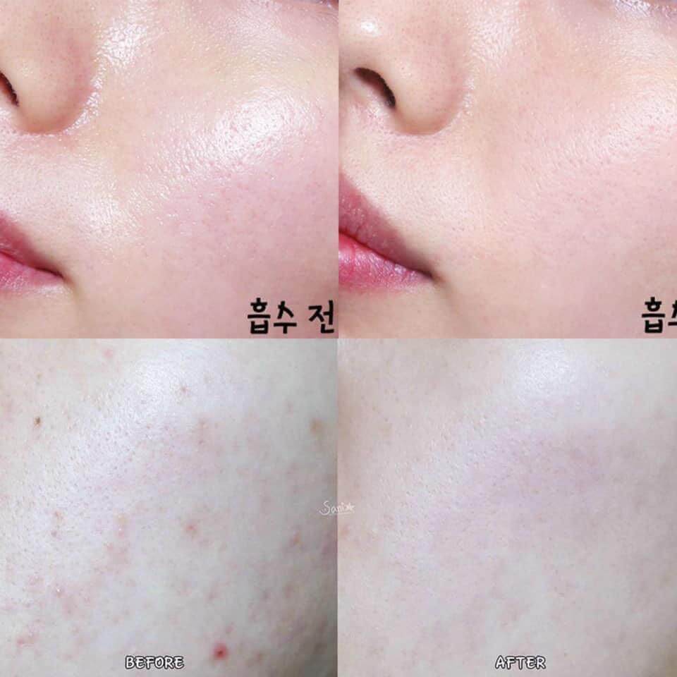 KEM Ủ TRẮNG GLOWING PACK Nhật Bản