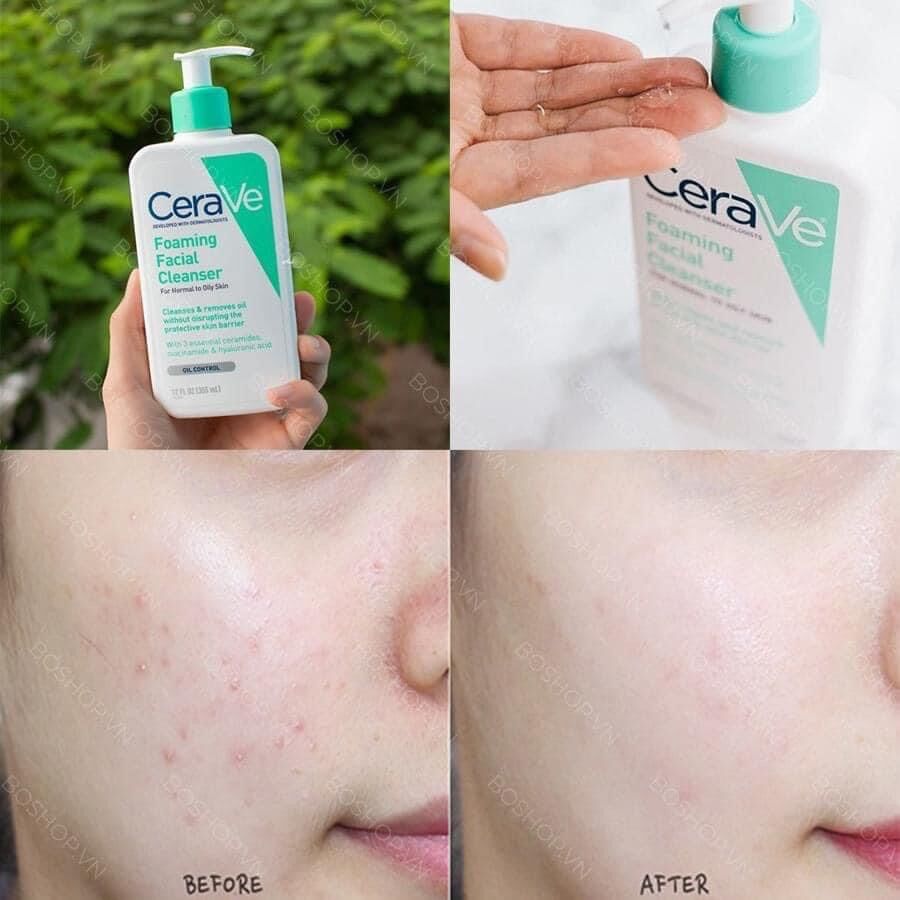 Sữa rửa mặt Cẻave cực kì an toàn và dịu nhẹ