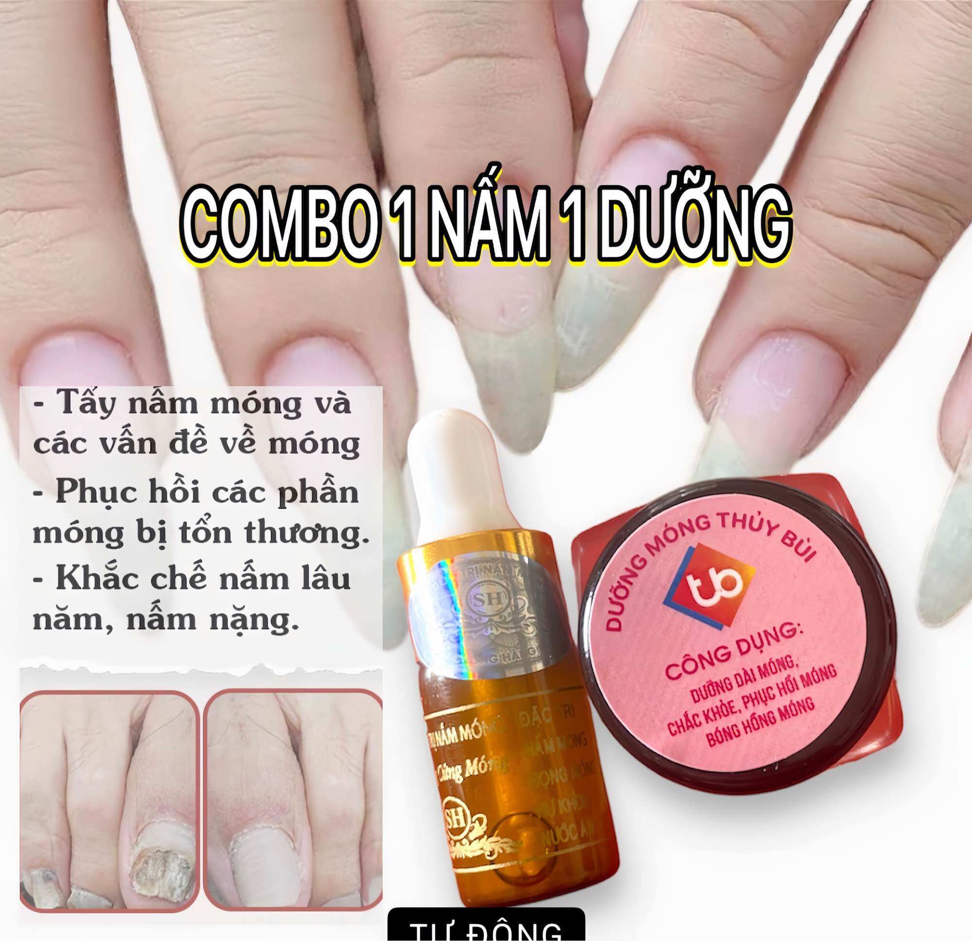 Dưỡng Móng Tay, Combo 1 lọ nấm và 1 hủ dưỡng móng