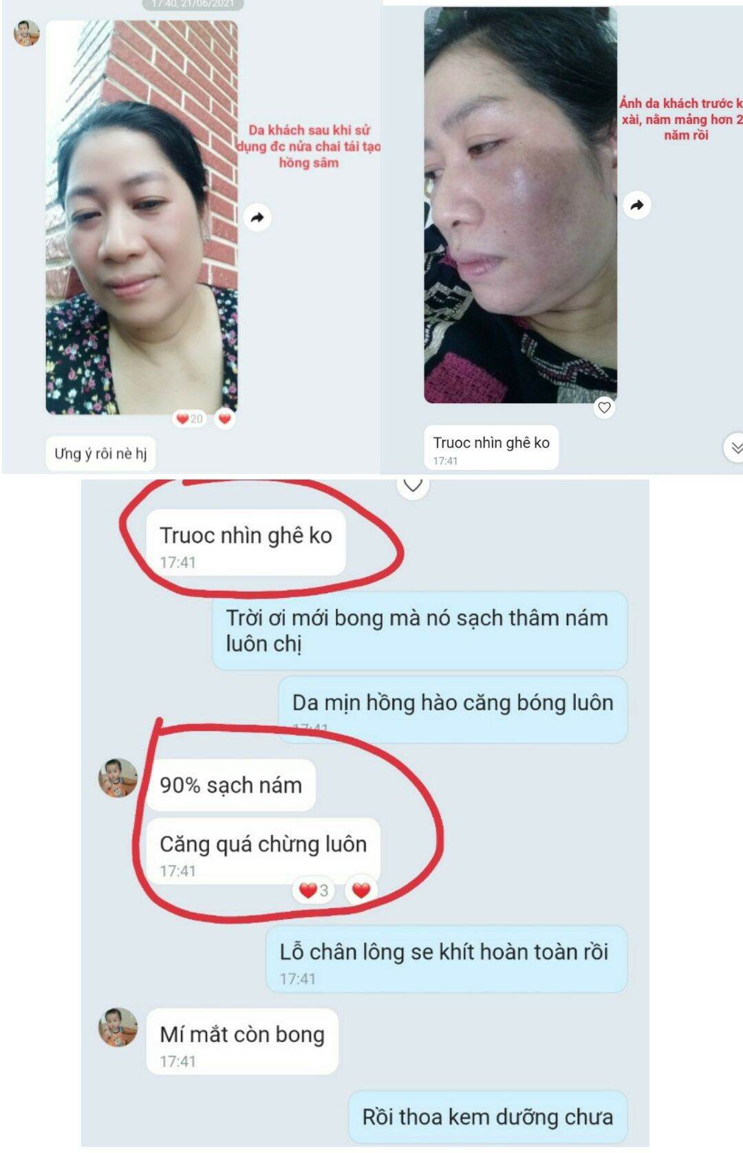 Combo Tái Tạo Hồng Sâm ( tinh chất hồng sâm + bột thảo dược rửa mặt)