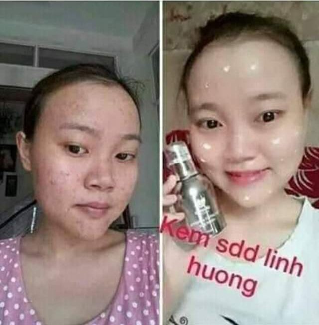 Kem sữa dinh dưỡng Linh Hương