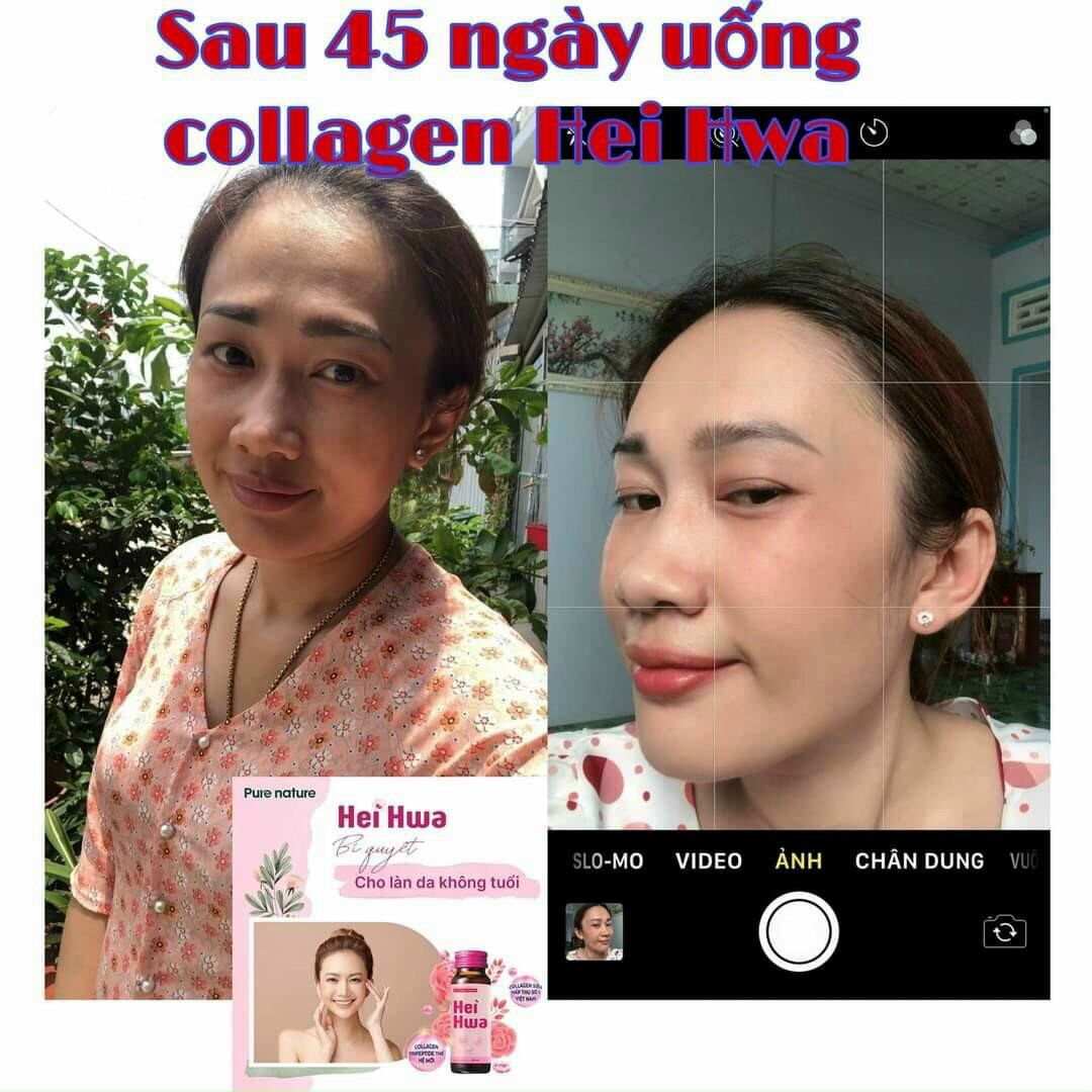 Collagen Tripeptide Hei Hwa siêu hấp thu ( Hộp 10 chai 30ml)