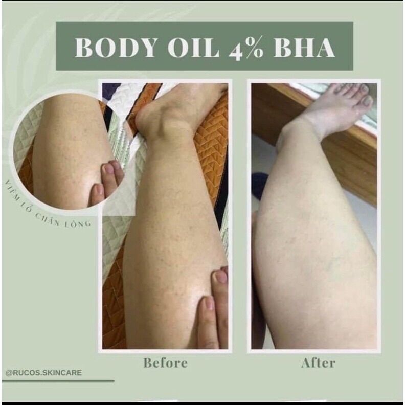 Body Oil Rucos 4%BHA
