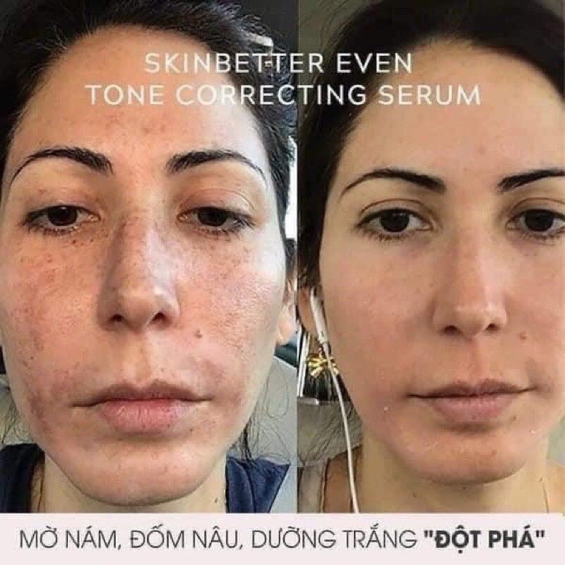 SERUM DƯỠNG SÁNG DA MỜ THÂM Eventone Correcting Serum
