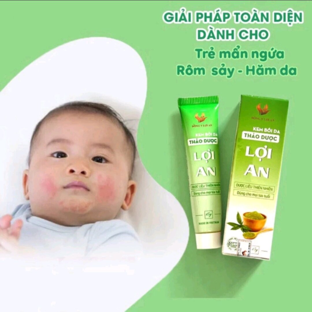 Kem bôi da thảo mộc Lợi An, hàng chuẩn