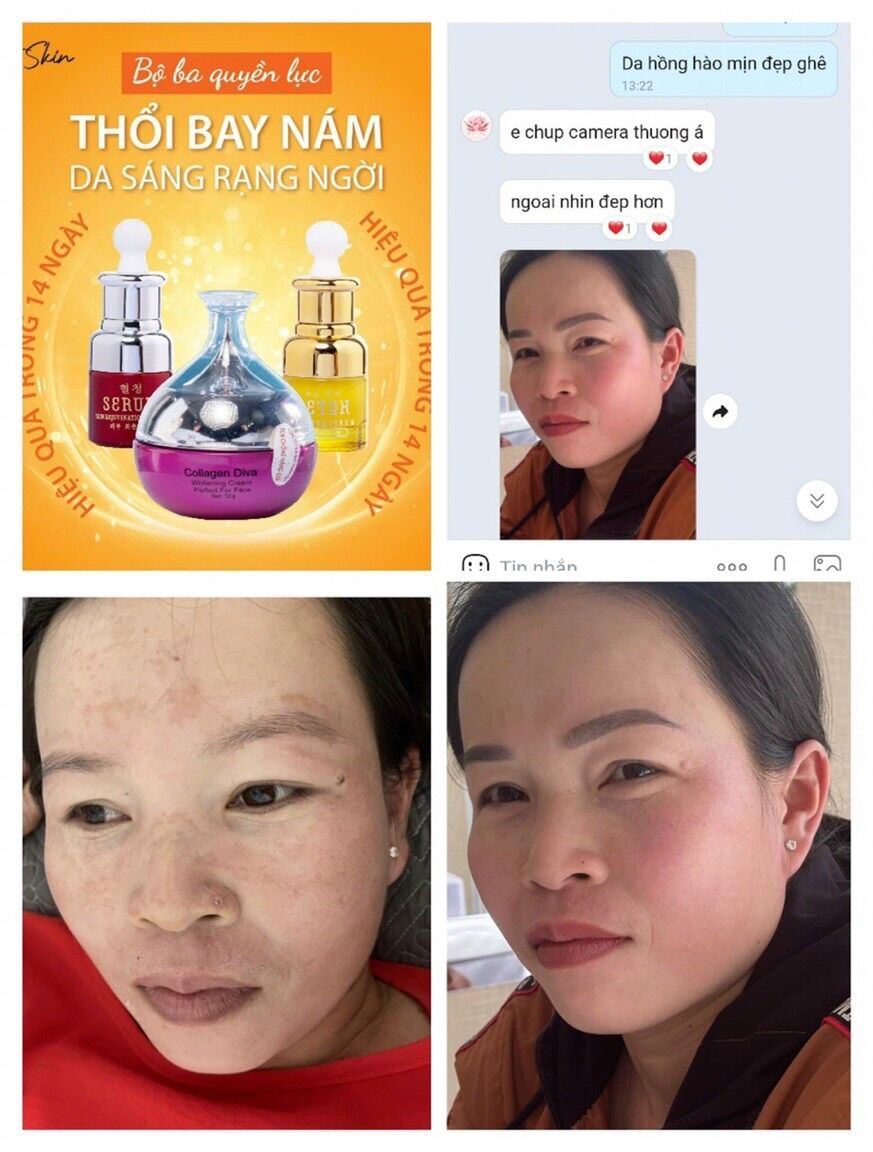 Serum siêu vitamin C