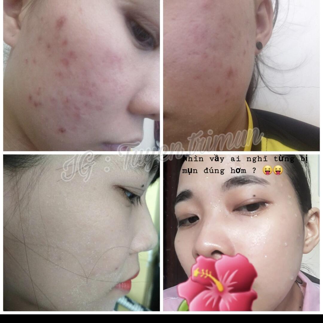 Đông y Sắc Ngọc Nữ tái tạo da