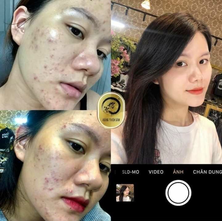 [FREESHIP] Combo Hoàng Thiên Sâm Phiên Bản VIP (Tinh Chất Tái Tạo Hoàng Thiên Sâm Vip & Bột Thảo Dược Rửa Mặt)