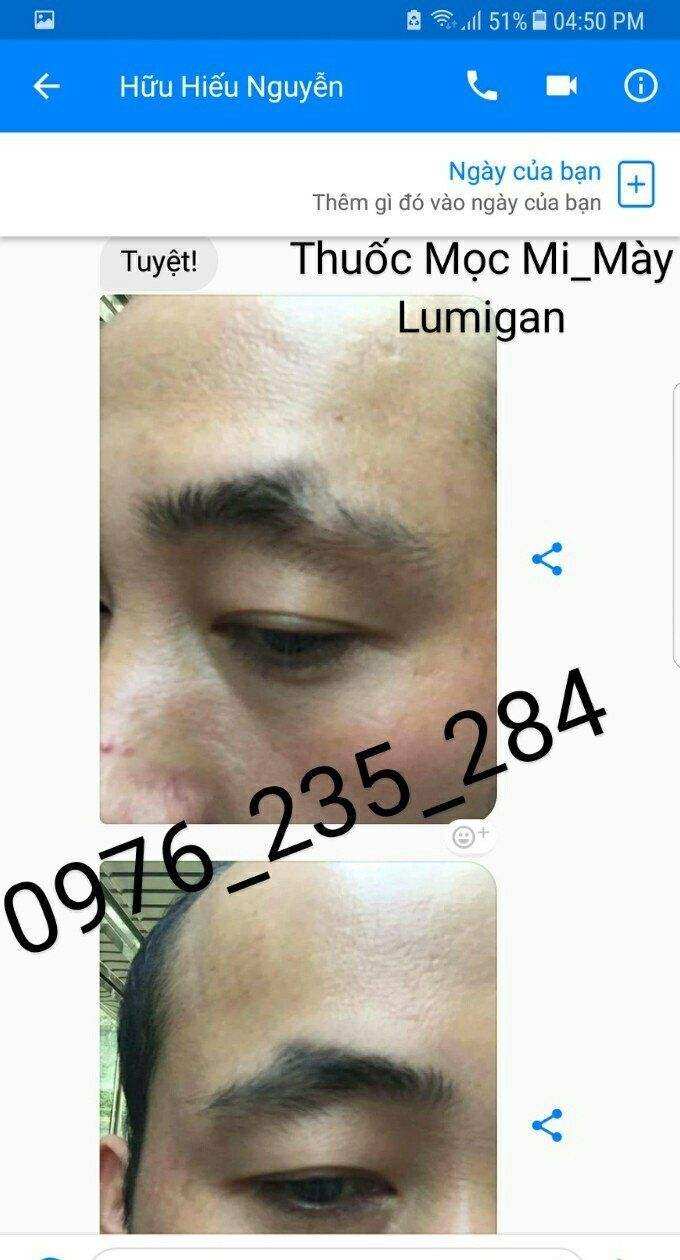 LUMIGAN MỌC LÔNG MÀY