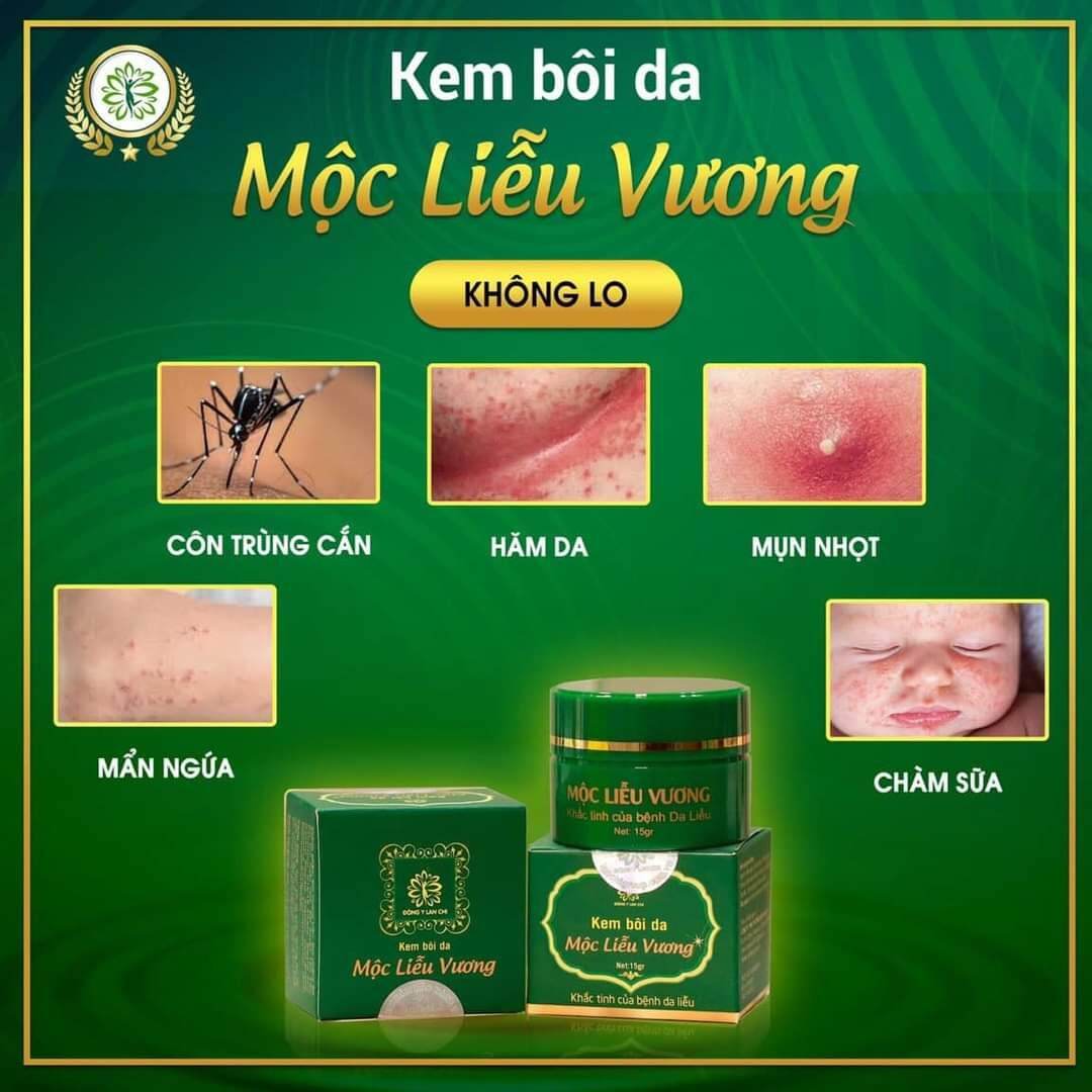 KEM BÔI DA MỘC LIỄU VƯƠNG (KHẮC TINH CÁC BỆNH VỀ DA )