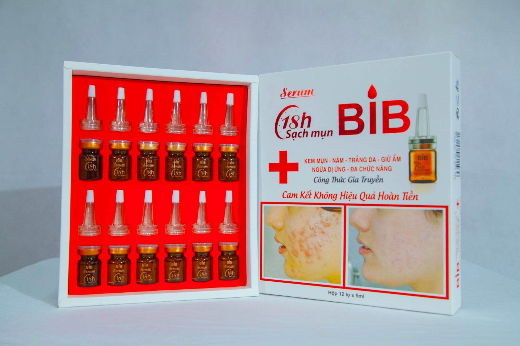 Sirum Mụn Chuyên Sâu (Tinh Chất Tế Bào Gốc)
