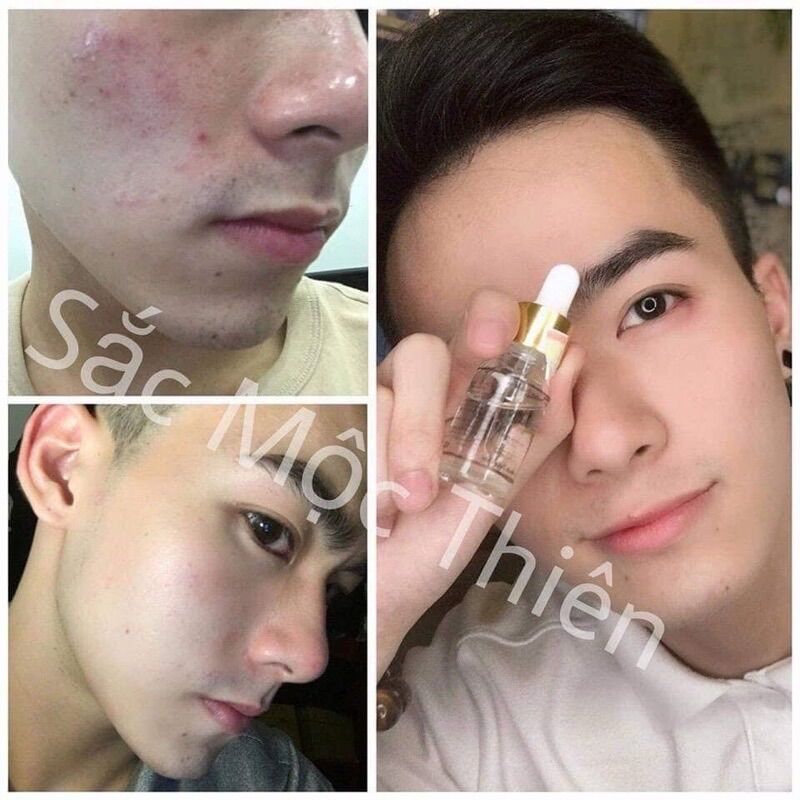 Combo 2 Chai Tinh Chất Dưỡng Da Sắc Mộc Thiên 10ml