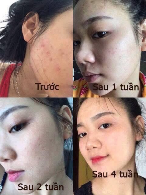 Tái Tạo Da MT (50ml).